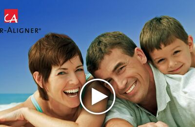 Video CA® CLEAR ALIGNER Animation